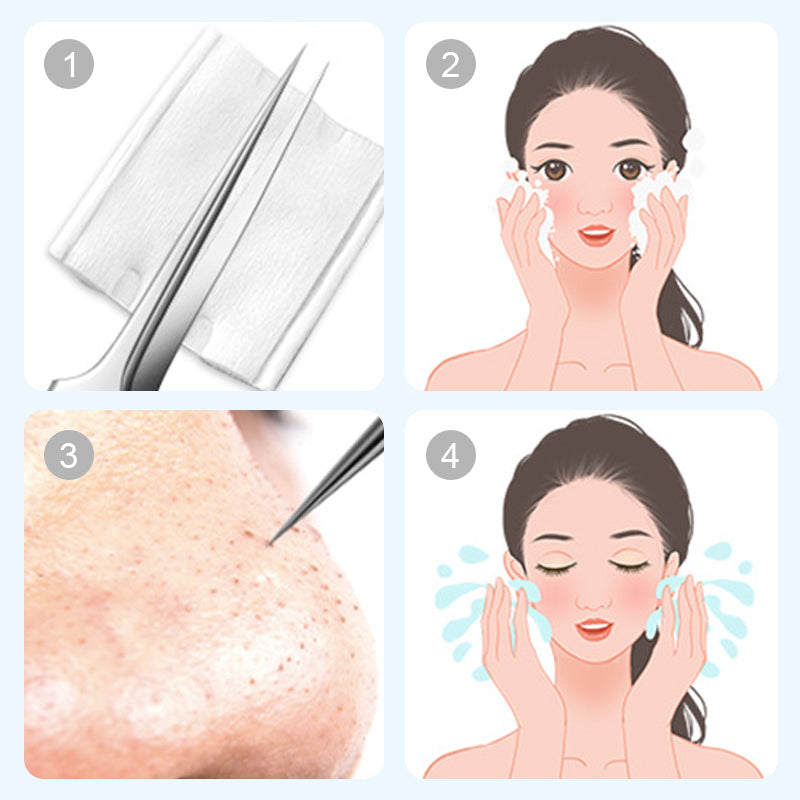 💓HOT SALE 42% OFF💥Stainless Steel Blackhead Remover Tool Kit