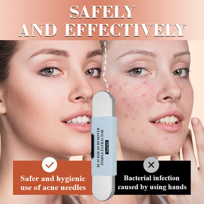 💓HOT SALE 42% OFF💥Stainless Steel Blackhead Remover Tool Kit