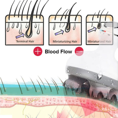 4-Wheel Deep Massage Electric Scalp Massager