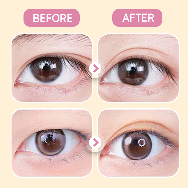 ✨Invisible Strong Support Double Eyelid Tapes for Enlarging Eyes