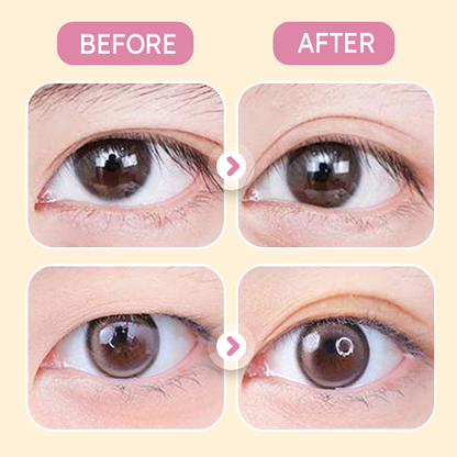 ✨Invisible Strong Support Double Eyelid Tapes for Enlarging Eyes