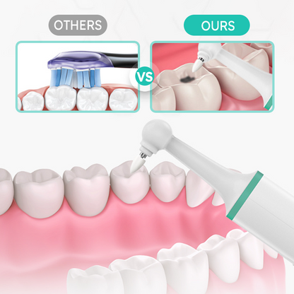 3-Speed Electric Tooth Polisher with 4 Replacement Head