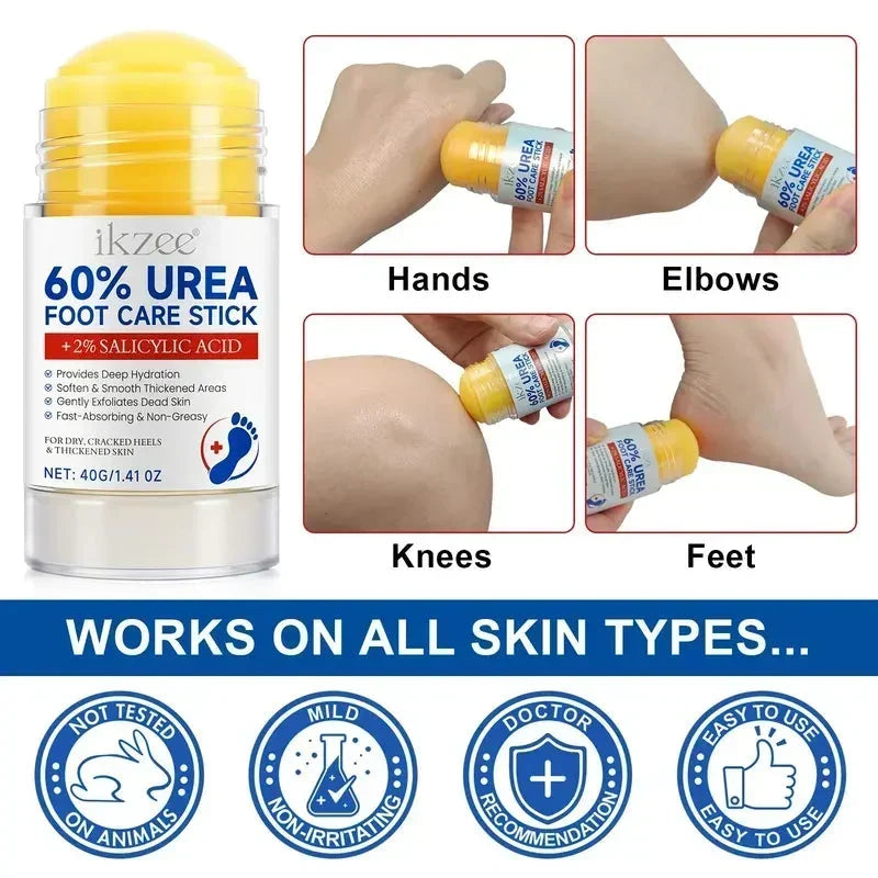 🎉Urea Foot Care Stick, Intensive Moisturizing Balm for Dry Cracked Heels & Dead Skin