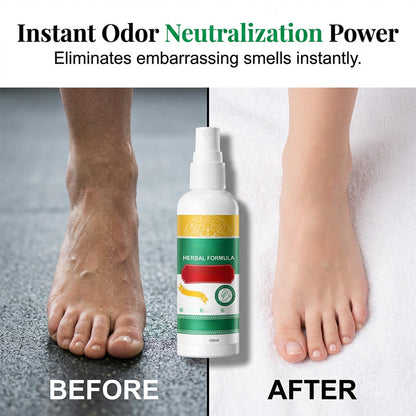 🥳HOT SALE🥳💞10K+ SOLD! Foot Care Spray –Herbal formula, removes calluses & neutralizes odor. Fresh feet – grab yours! ✅