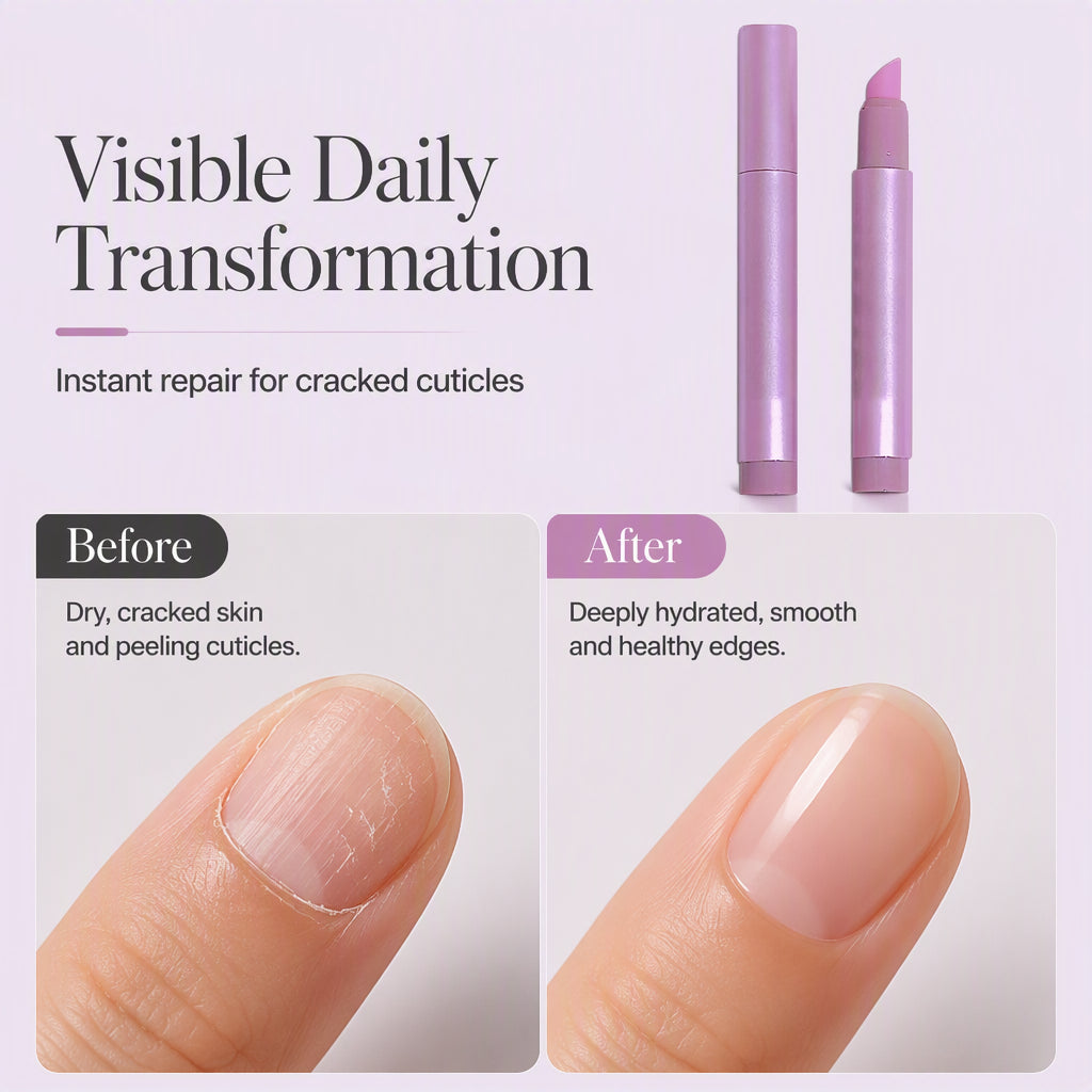 Portable Nail Care Essence Pen – Precise Cuticle Moisturizing Treatment